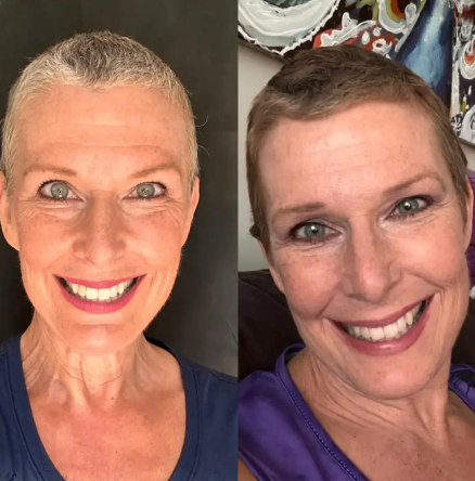 NovaHair™️