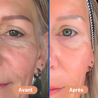 NOVA™ – Pansement en Silicone